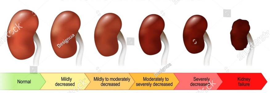 Community Invited to Learn How to Protect Kidney Health