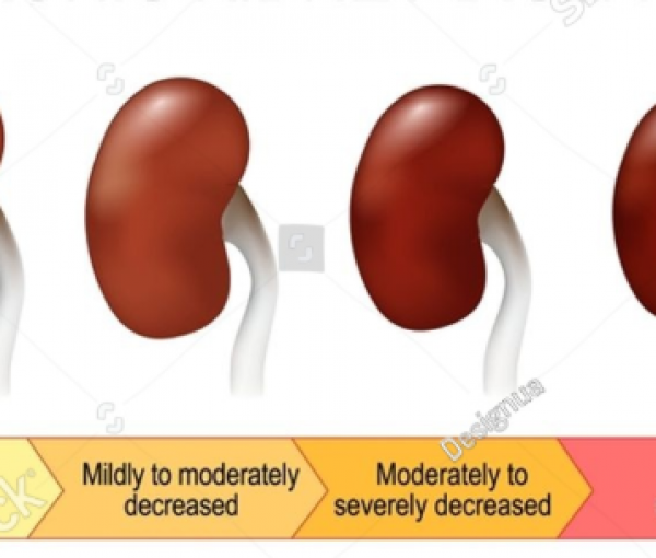 Community Invited to Learn How to Protect Kidney Health